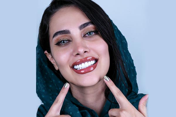 قیمت-لمینت-دندان در مشهد