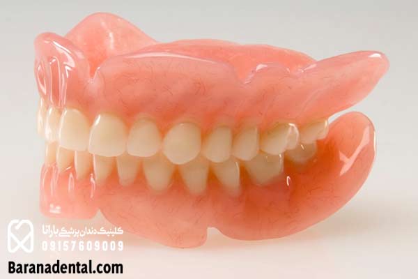 پروتز كامل دندان