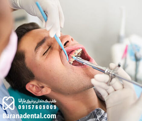 تزریق بی حسی موضعی در محل کشیدن دندان