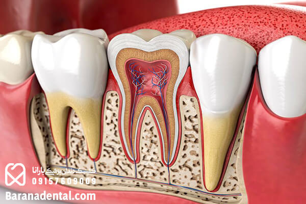 عوارض کشیدن دندان