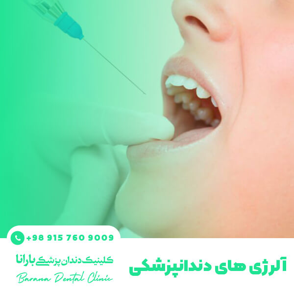 حساسیت های مرتبط با دهان و دندان