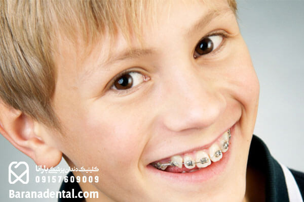 سفید کردن دندان کودکان