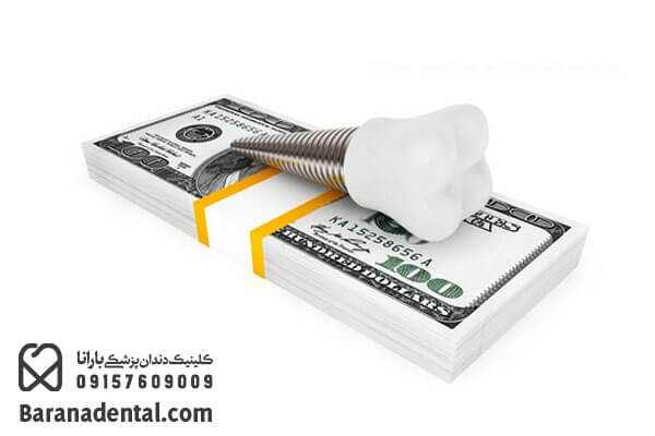 قیمت ایمپلنت دندان