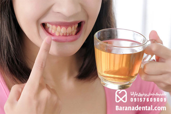 زرد شدن دندان به دلیل مصرف برخی از نوشیدنی ها