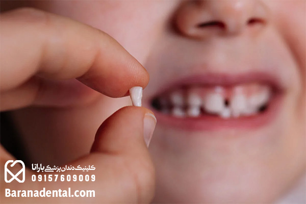 دندان شیری کودکان چیست
