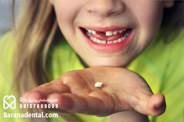 چگونگی افتادن دندان شیری کودکان