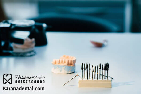 معایب روش های کاشت دندان 
