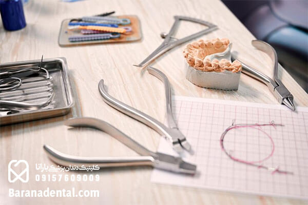 روش های مختلف کاشت دندان