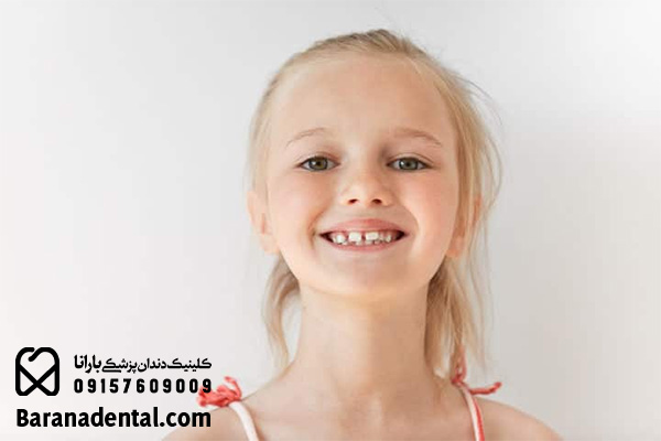فاصله بین دو دندان در کودکان