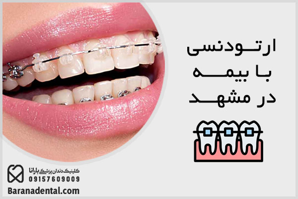 ارتودنسی دندان با بیمه در مشهد