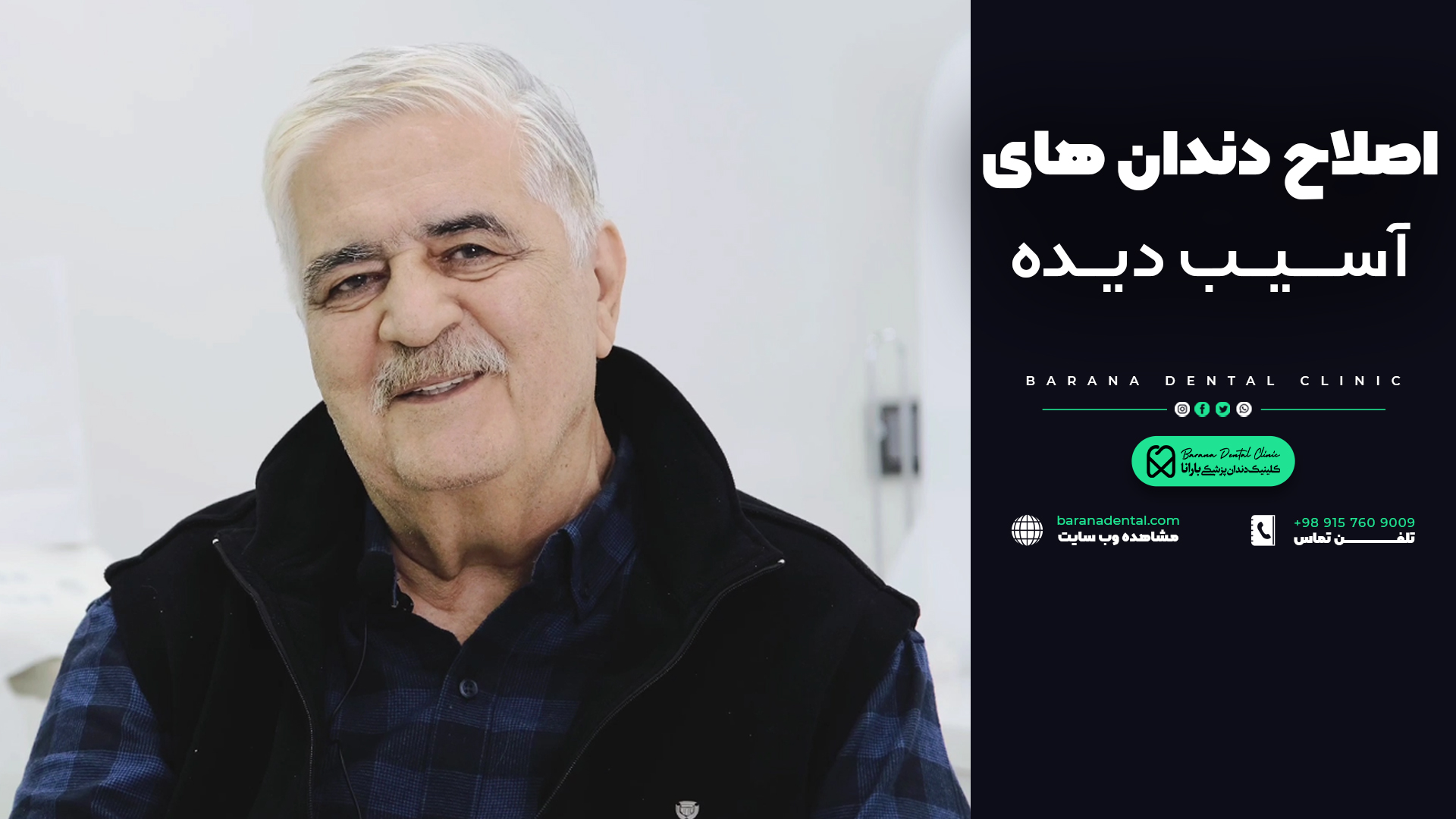 اصلاح طرح لبخند در بارانا