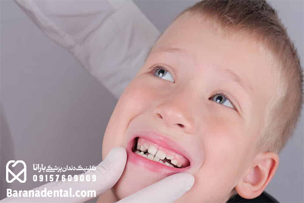 دندان های کج را چگونه میتوان درمان کرد