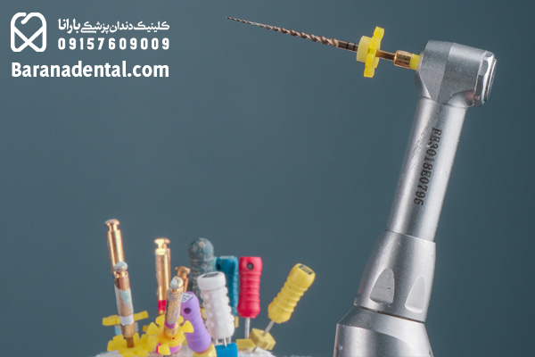 درمان تخصصی ریشه دندان با دستگاه روتاری