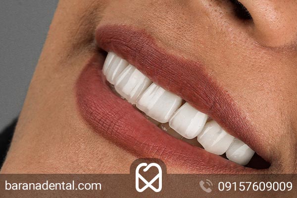 انواع دندان ها؛ دندان های قدامی