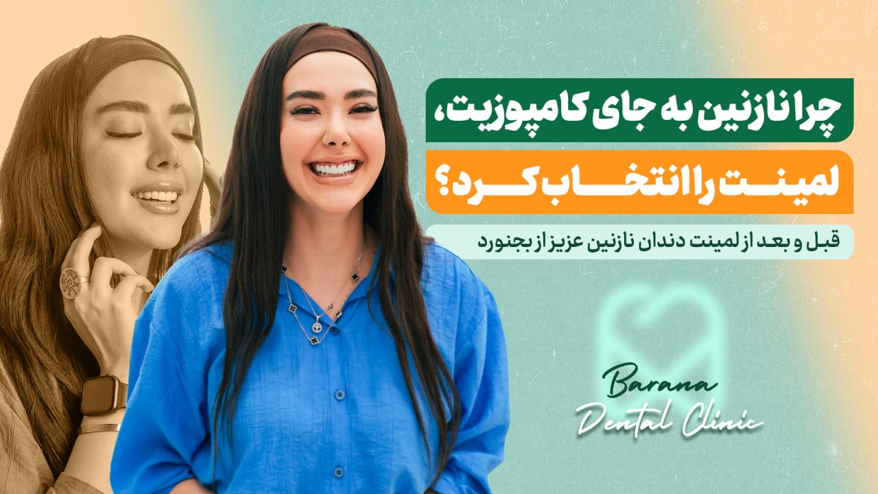 لمینت دندان نازنین عزیز در بارانا
